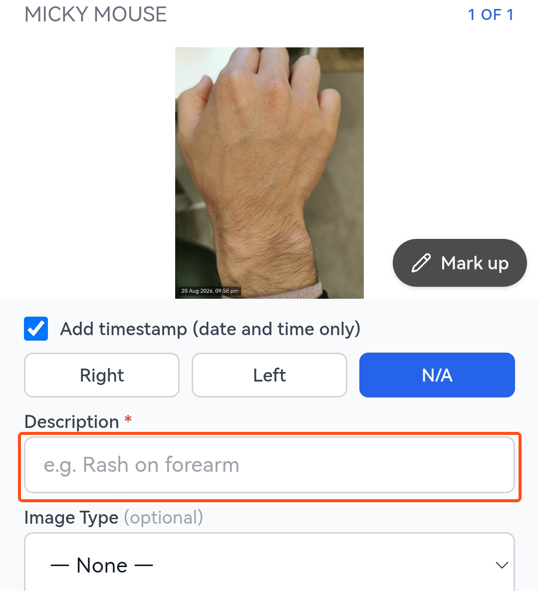 Naming the image